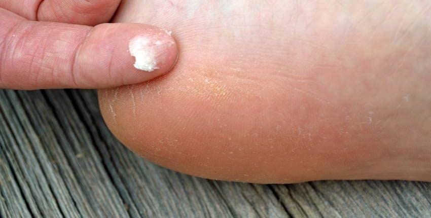 Applying Happy Feet