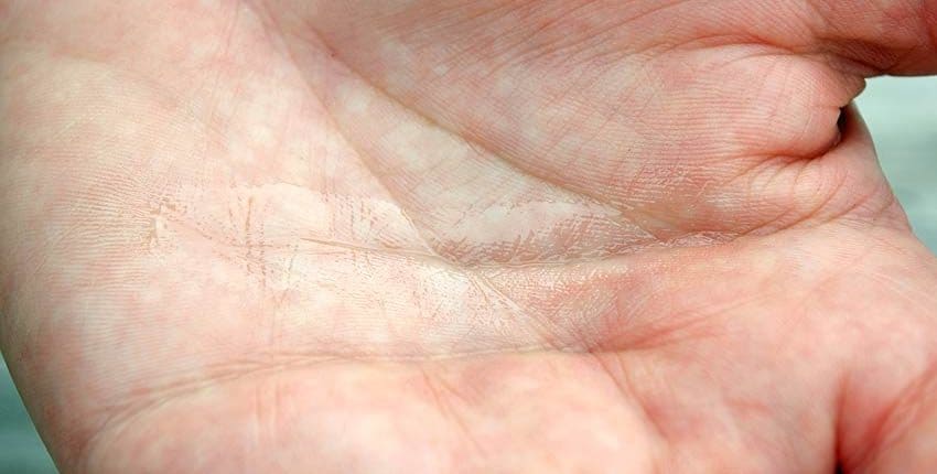 Shea Butter on Hand